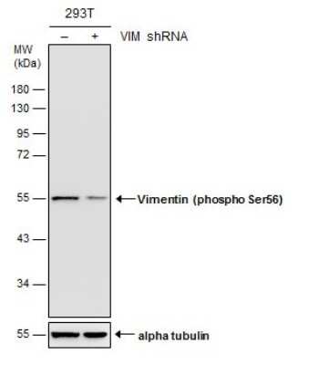 Western Blot: Vimentin [p Ser56] Antibody [NBP3-13119]
